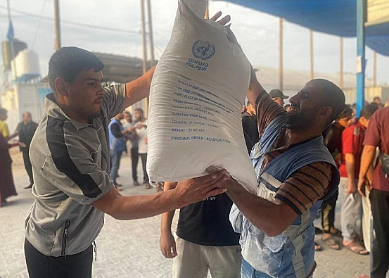 Ket. Foto: Sejak Perang, Tercatat Lebih dari 4.000 Amputasi dan 2.000 Kasus Cedera Tulang Belakang serta Otak di Jalur Gaza