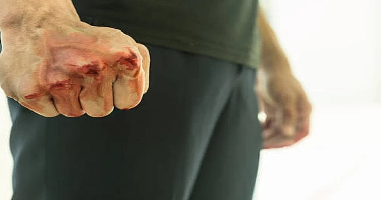 Viral seorang siswa SMP tega dikeroyok sejumlah remaja lainnya hingga harus menjalani perawatan