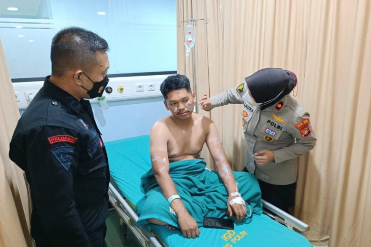 Brimob Yon B Cipinang alami luka bakar serius dalam tawuran di Bassura. Polisi buru pelaku yang siram air keras.
