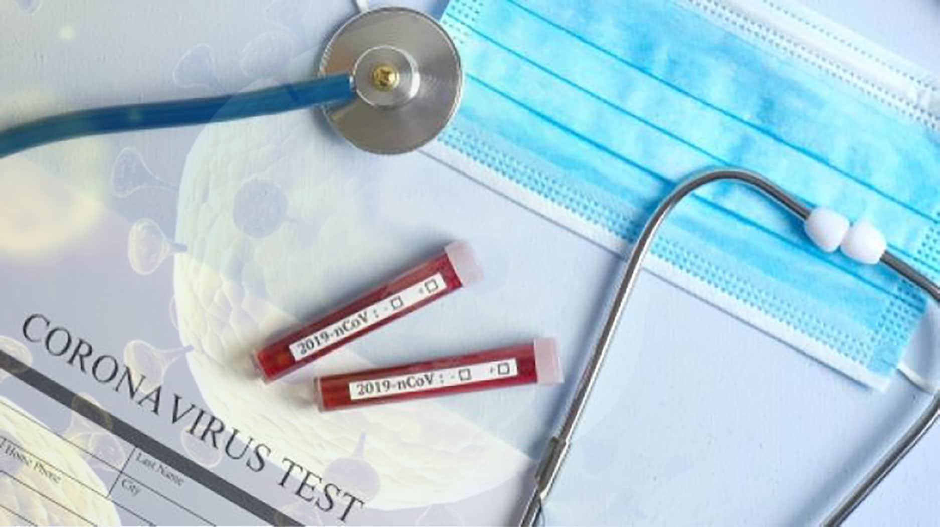 <p>Data corona Kota Palu Terkini (GemasulawesiFoto/Rafii)</p>
