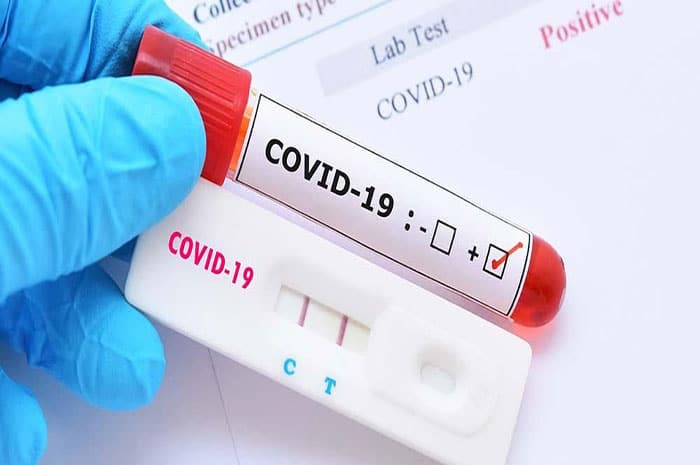 <p>Ilustrasi Covid Test</p>
