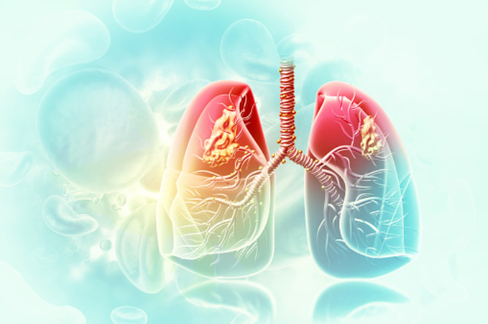 <p>Ket Foto: Ilustrasi paru &#8211; paru terpapar tuberculosis (Foto/Pixabay)</p>
