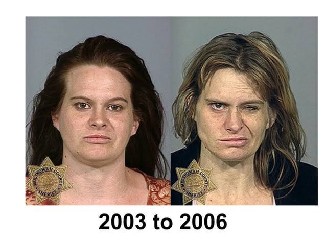 <p>Ket. Efek sebelum dan sesudah konsumsi narkotika (Foto/NYPD) </p>
