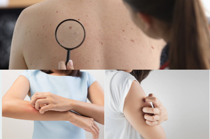 <p>Ket Foto: Panu dapat menyebabkan gatal yang sangat mengganggu dan harus segera diobati (Foto/Freepic)</p>
